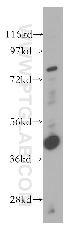 Western Blot (WB) analysis of PC-3 cells using RASSF6 Polyclonal antibody (11921-1-AP)