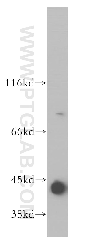 Western Blot (WB) analysis of HeLa cells using RASSF6 Polyclonal antibody (11921-1-AP)