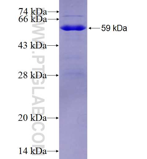 RASSF8 fusion protein Ag3492 SDS-PAGE
