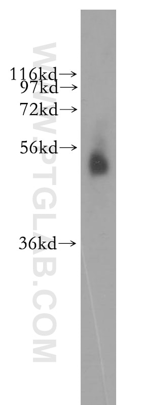 Western Blot (WB) analysis of human liver tissue using PAMCI Polyclonal antibody (12861-1-AP)