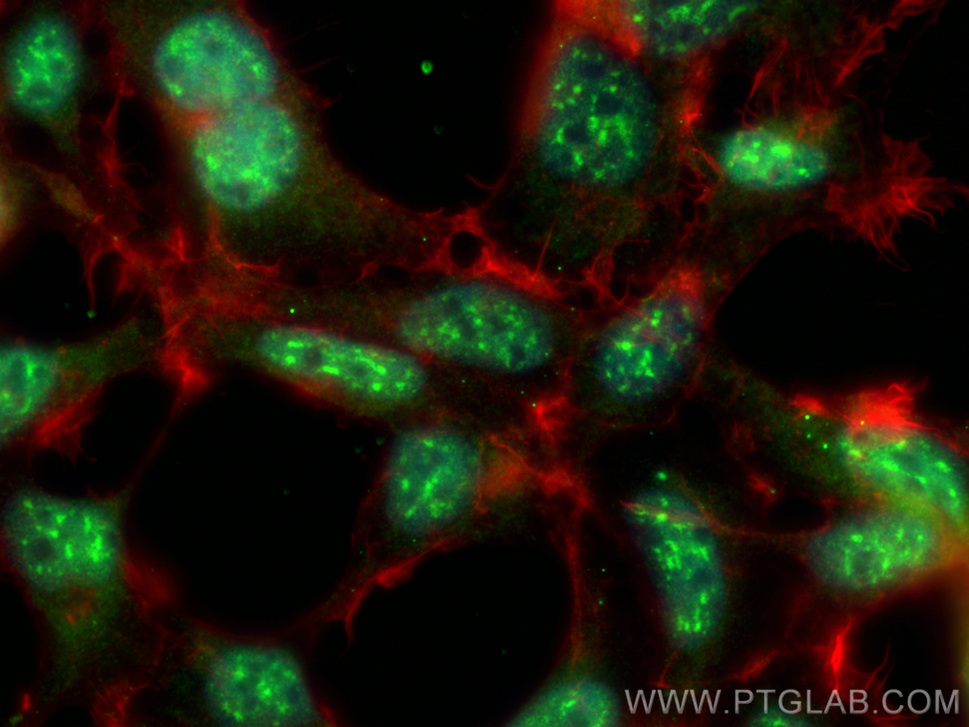 Immunofluorescence (IF) / fluorescent staining of HEK-293 cells using RAVER2 Polyclonal antibody (32025-1-AP)