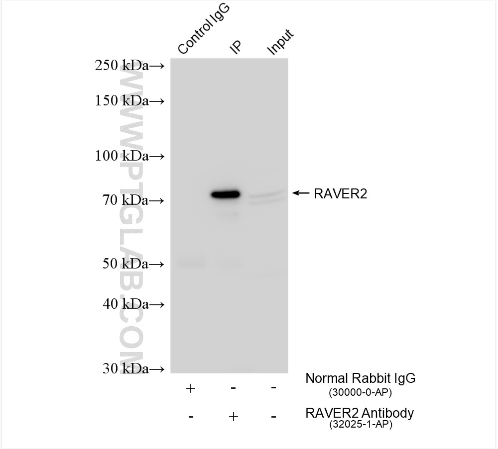 Immunoprecipitation (IP) experiment of HEK-293T cells using RAVER2 Polyclonal antibody (32025-1-AP)