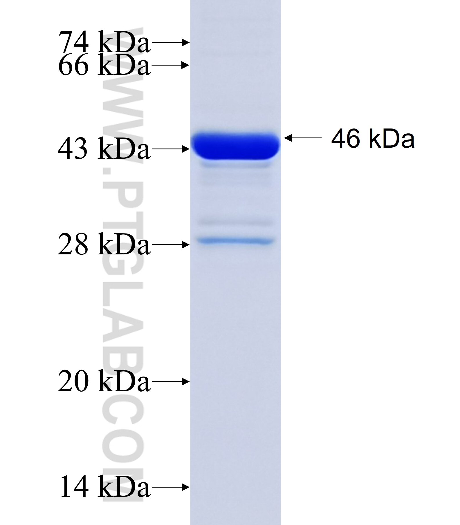 RAX fusion protein Ag19364 SDS-PAGE