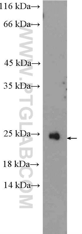Western Blot (WB) analysis of Jurkat cells using RAX2 Polyclonal antibody (11466-1-AP)