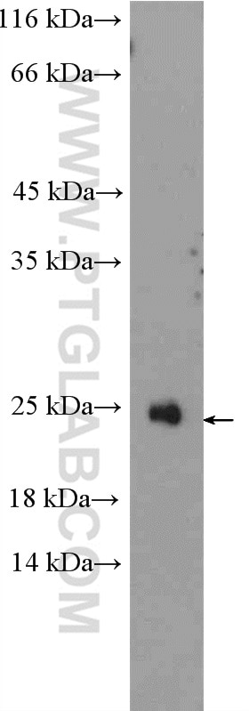 WB analysis of Jurkat using 11466-1-AP