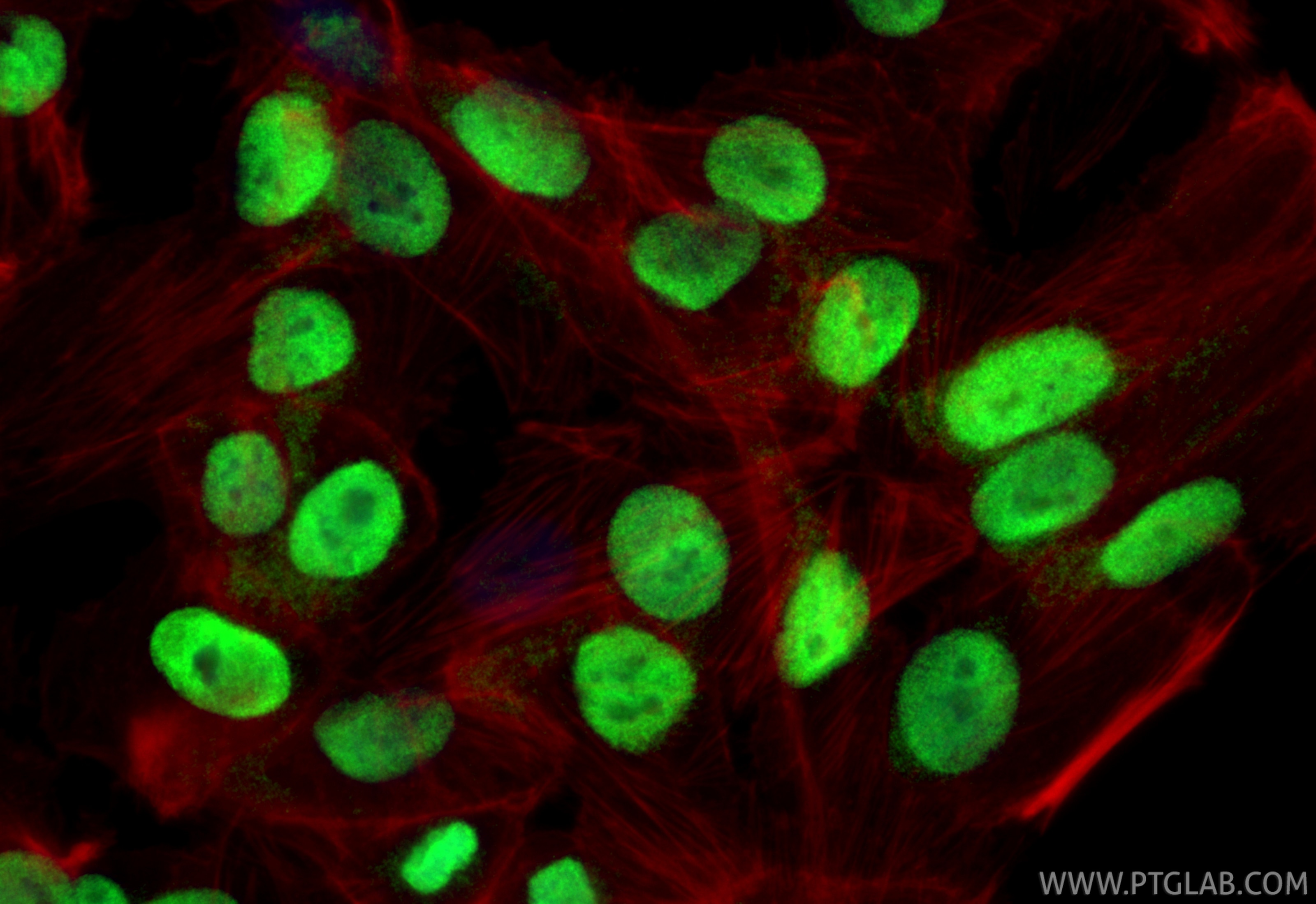 Immunofluorescence (IF) / fluorescent staining of hTERT-RPE1 cells using RB1 Polyclonal antibody (10048-2-Ig)