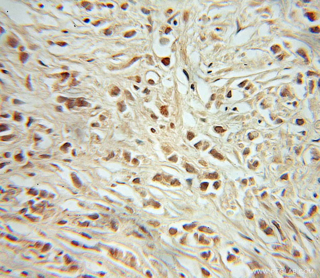 RB1 Polyclonal antibody