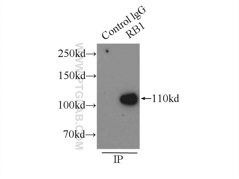 Immunoprecipitation (IP) experiment of A431 cells using RB1 Polyclonal antibody (10048-2-Ig)