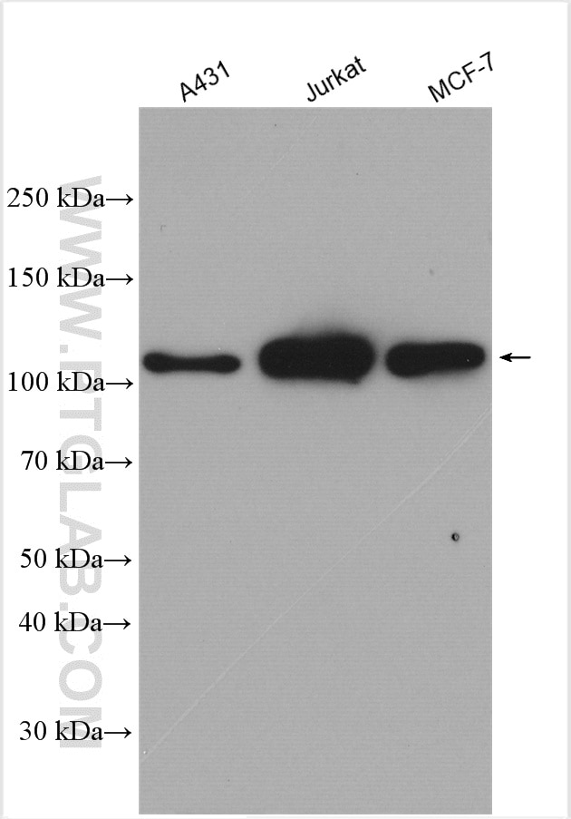 Western Blot (WB) analysis of various lysates using RB1 Polyclonal antibody (10048-2-Ig)