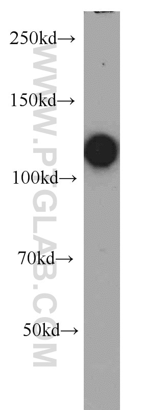 RB1 Polyclonal antibody
