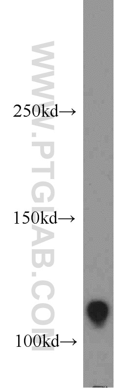 Western Blot (WB) analysis of HT-1080 cells using RB1 Polyclonal antibody (17218-1-AP)