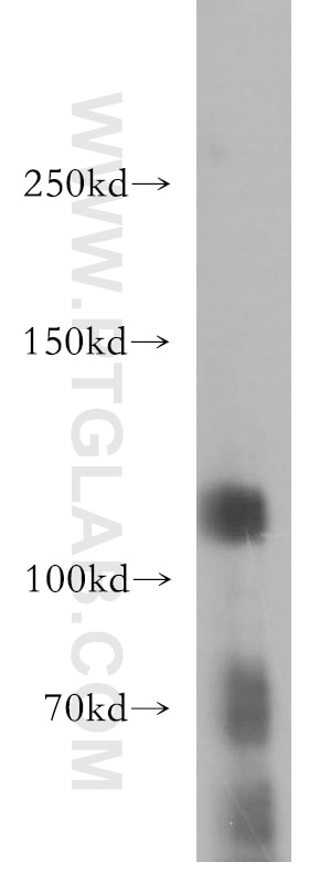 Western Blot (WB) analysis of HT-1080 cells using Rb Polyclonal antibody (17218-1-AP)