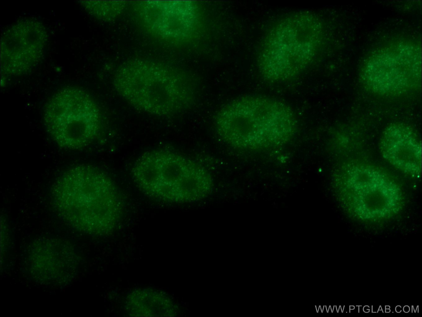 Immunofluorescence (IF) / fluorescent staining of HepG2 cells using RB1 Polyclonal antibody (25628-1-AP)