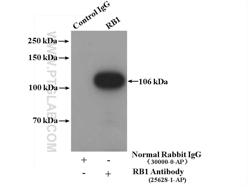 Immunoprecipitation (IP) experiment of Jurkat cells using RB1 Polyclonal antibody (25628-1-AP)