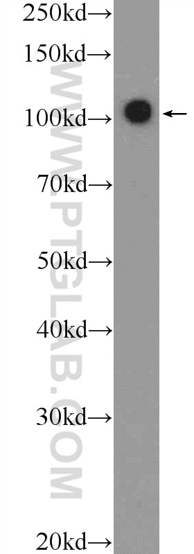 Western Blot (WB) analysis of Jurkat cells using RB1 Polyclonal antibody (25628-1-AP)