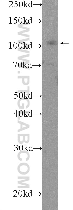 Western Blot (WB) analysis of A431 cells using RB1 Polyclonal antibody (25628-1-AP)