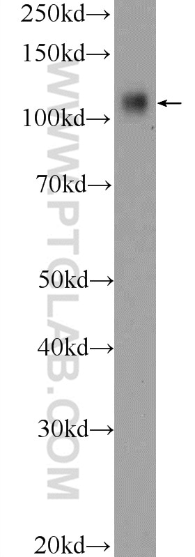 Western Blot (WB) analysis of Jurkat cells using RB1 Polyclonal antibody (25628-1-AP)