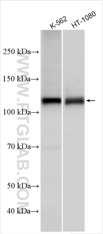 Western Blot (WB) analysis of various lysates using RB1 Polyclonal antibody (30373-1-AP)