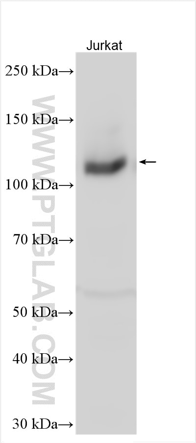 Western Blot (WB) analysis of various lysates using RB1 Polyclonal antibody (30374-1-AP)
