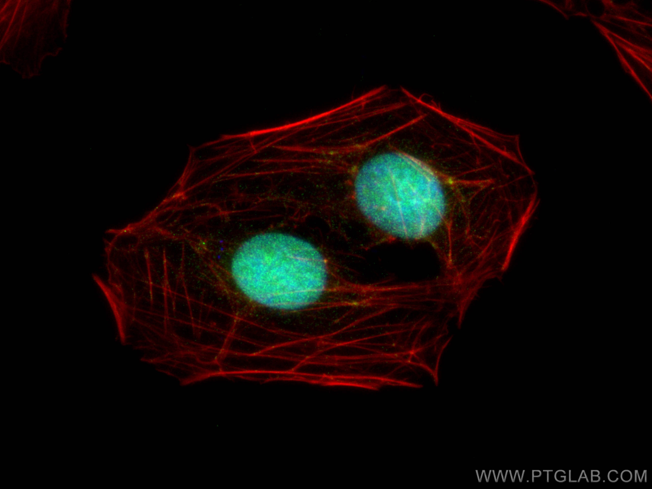 Immunofluorescence (IF) / fluorescent staining of U2OS cells using RB1 Monoclonal antibody (67521-1-Ig)