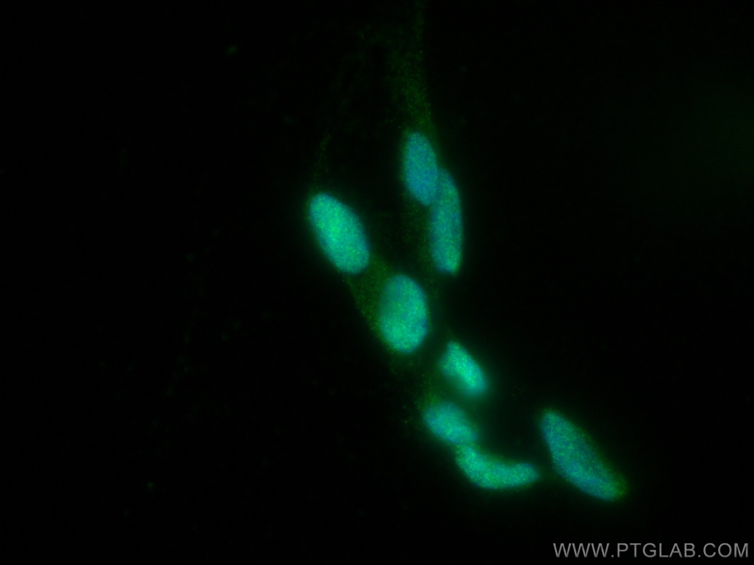 Immunofluorescence (IF) / fluorescent staining of SH-SY5Y cells using RB1 Monoclonal antibody (67521-1-Ig)