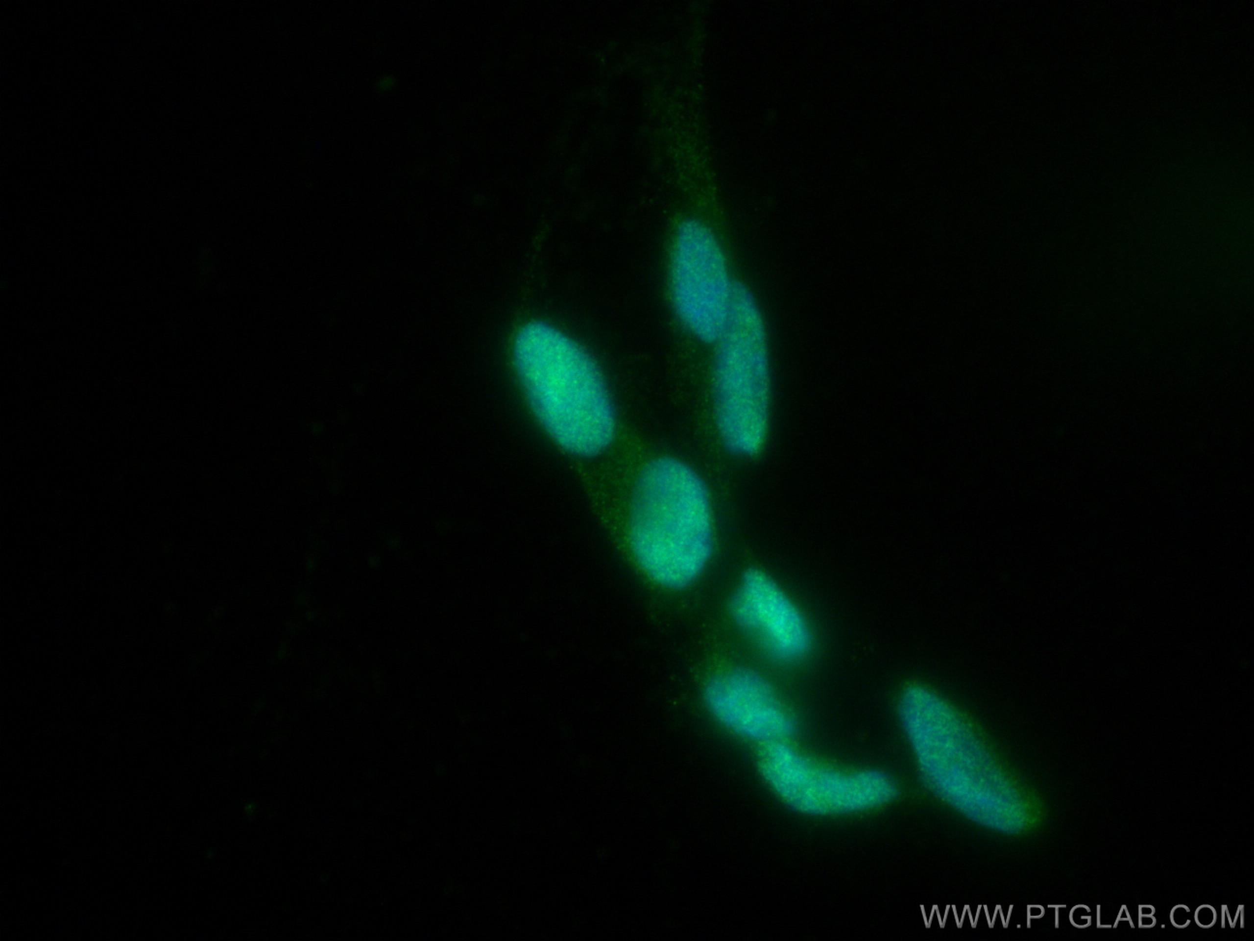 IF Staining of SH-SY5Y using 67521-1-Ig