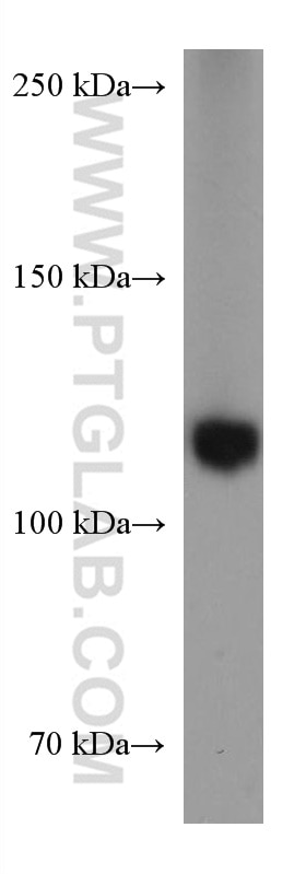 Western Blot (WB) analysis of Jurkat cells using RB1 Monoclonal antibody (67521-1-Ig)