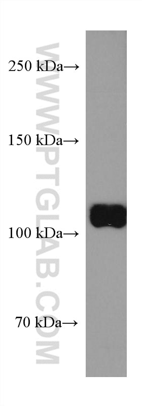 Western Blot (WB) analysis of MCF-7 cells using RB1 Monoclonal antibody (67521-1-Ig)