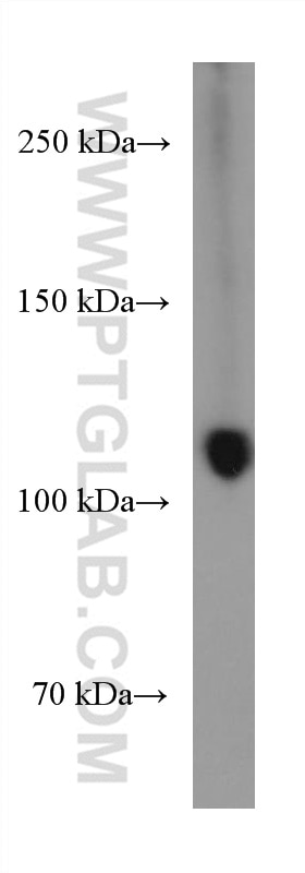 Western Blot (WB) analysis of Jurkat cells using RB1 Monoclonal antibody (67521-1-Ig)