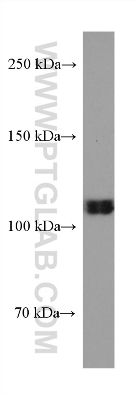 Western Blot (WB) analysis of K-562 cells using RB1 Monoclonal antibody (67521-1-Ig)