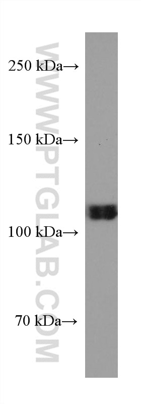 WB analysis of K-562 using 67521-1-Ig