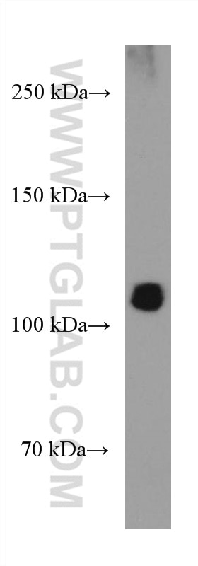 Western Blot (WB) analysis of HL-60 cells using RB1 Monoclonal antibody (67521-1-Ig)