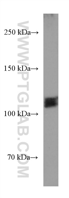 Western Blot (WB) analysis of TF-1 cells using RB1 Monoclonal antibody (67521-1-Ig)