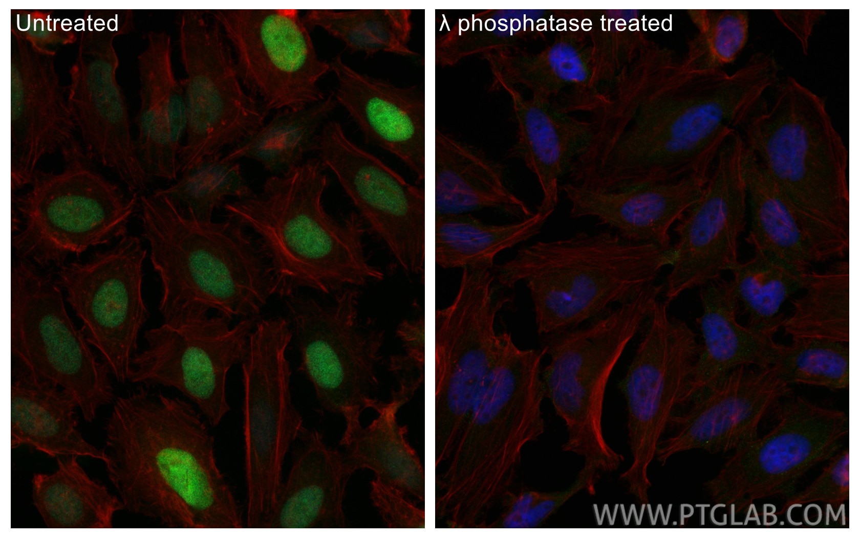 Immunofluorescence (IF) / fluorescent staining of HeLa cells using Phospho-RB1 (Ser780) Recombinant monoclonal antibo (84692-1-RR)
