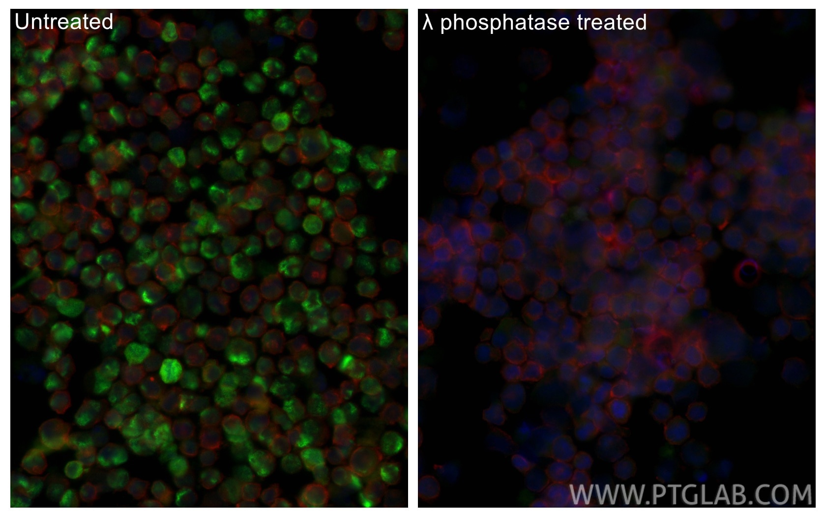 Immunofluorescence (IF) / fluorescent staining of K-562 cells using Phospho-RB1 (Ser780) Recombinant monoclonal antibo (84692-1-RR)