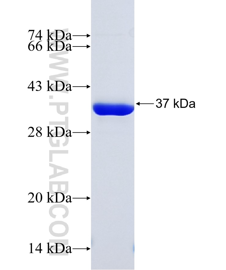 RB1 fusion protein Ag21936 SDS-PAGE