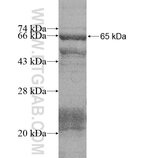 RB1 fusion protein Ag11035 SDS-PAGE