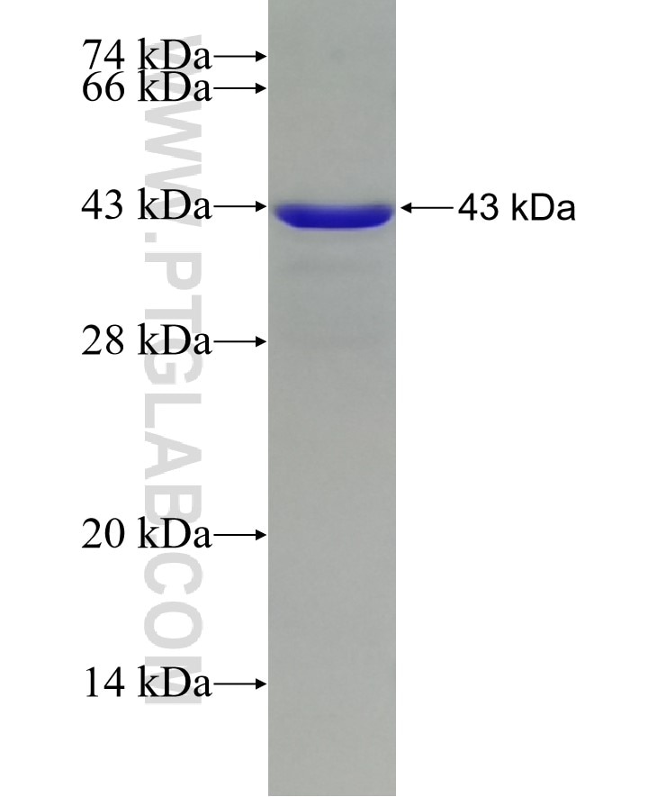RB1 fusion protein Ag11211 SDS-PAGE
