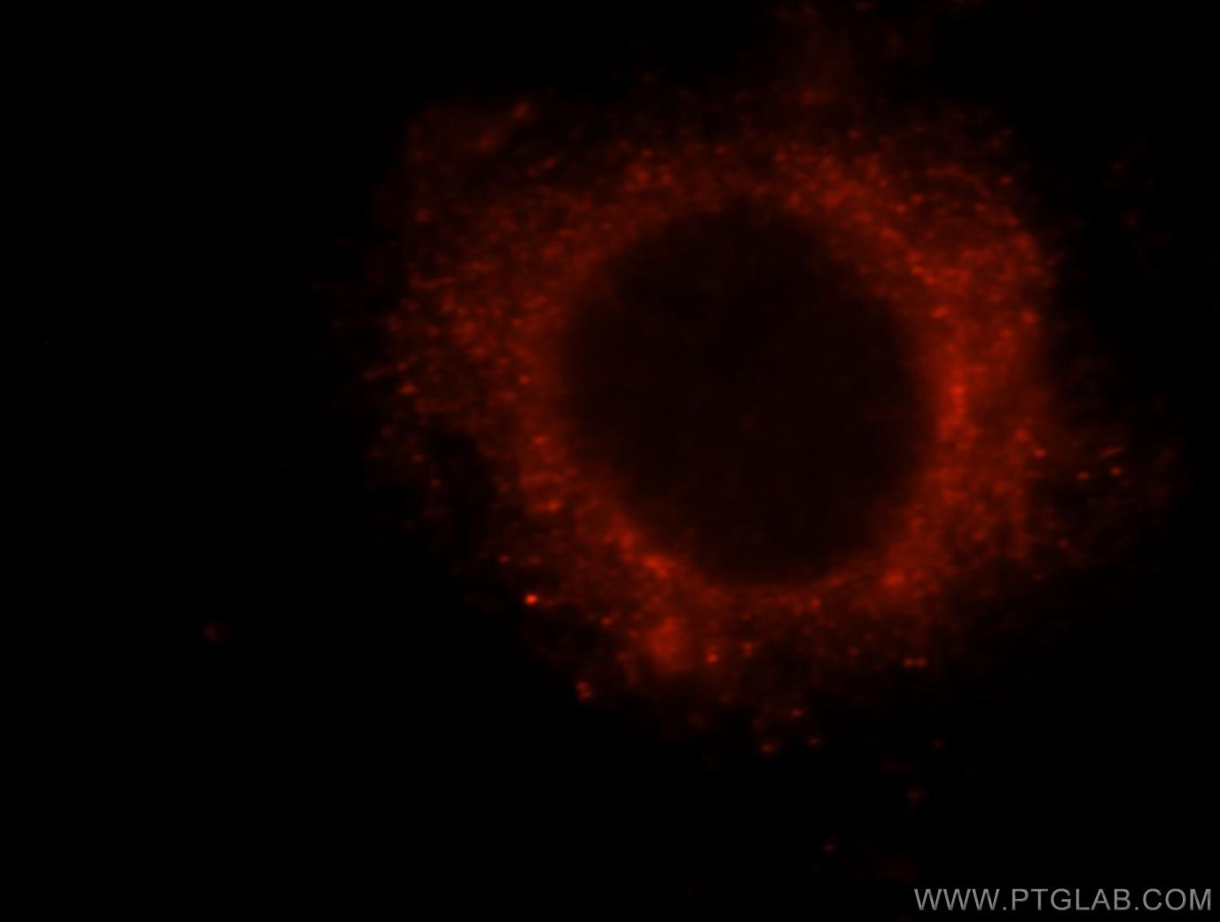 IF Staining of HeLa using 10043-2-AP