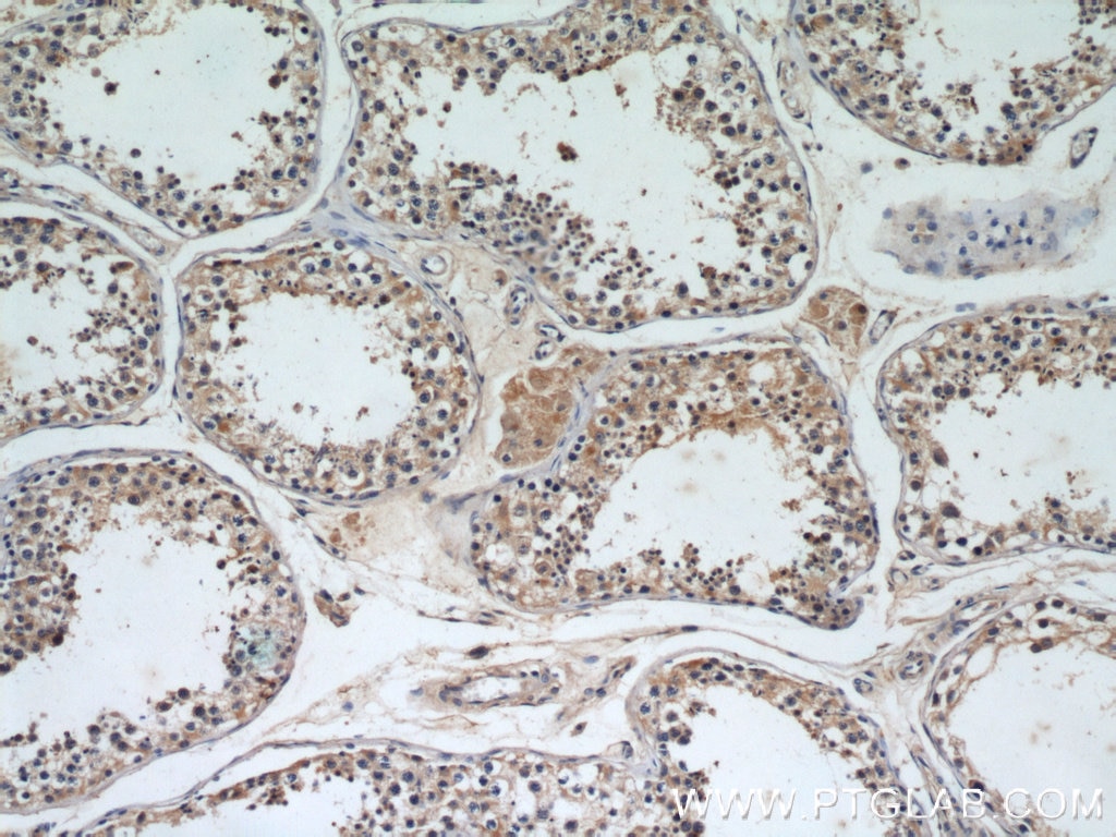 IHC staining of human testis using 10043-2-AP