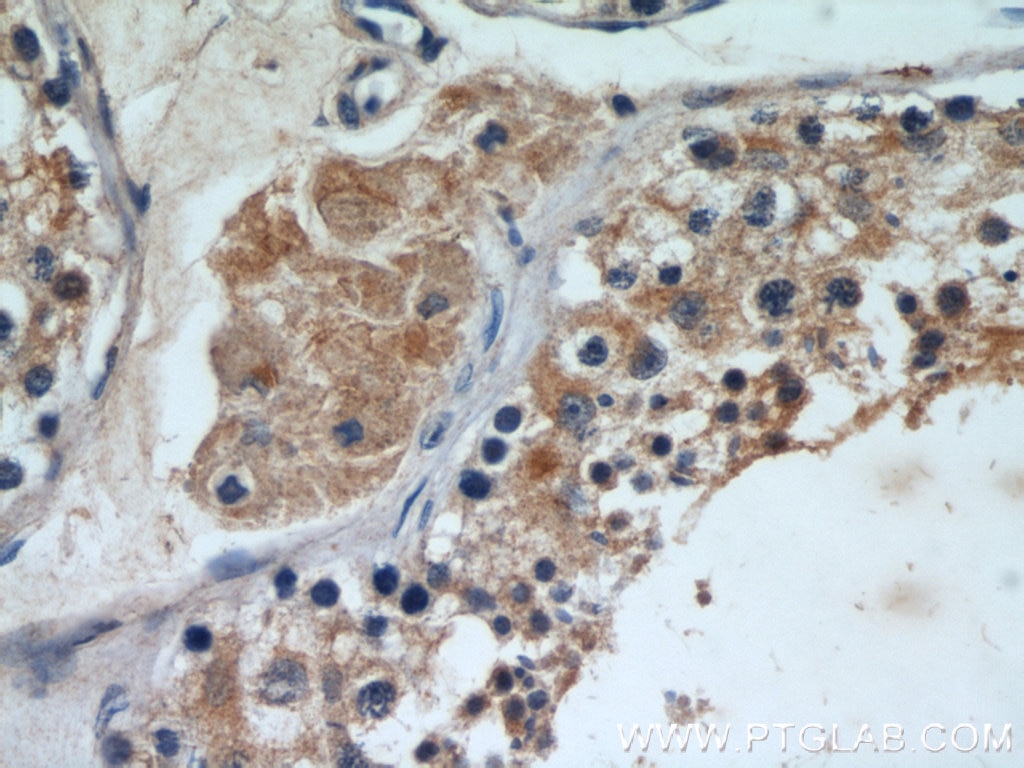 Immunohistochemistry (IHC) staining of human testis tissue using RB1CC1 Polyclonal antibody (10043-2-AP)