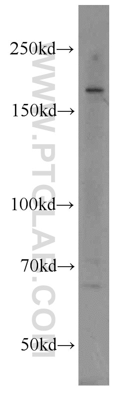 WB analysis of MCF-7 using 10043-2-AP