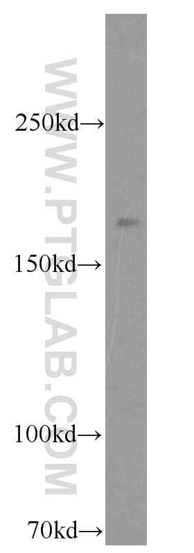 Western Blot (WB) analysis of HeLa cells using RB1CC1 Polyclonal antibody (10043-2-AP)