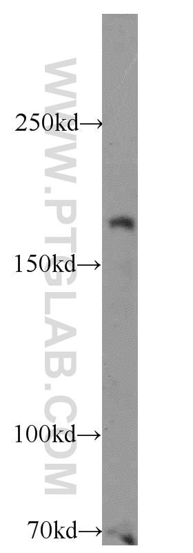 WB analysis of HeLa using 10043-2-AP