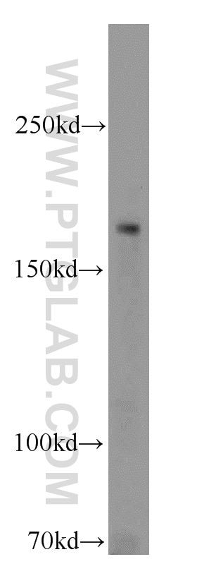 WB analysis of HeLa using 10043-2-AP