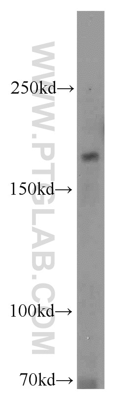 Western Blot (WB) analysis of HeLa cells using RB1CC1 Polyclonal antibody (10043-2-AP)