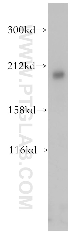 Western Blot (WB) analysis of mouse brain tissue using RB1CC1 Polyclonal antibody (10043-2-AP)