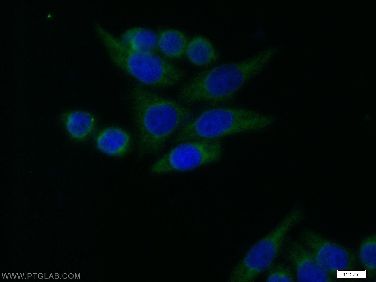 Immunofluorescence (IF) / fluorescent staining of HeLa cells using RB1CC1 Polyclonal antibody (10069-1-AP)