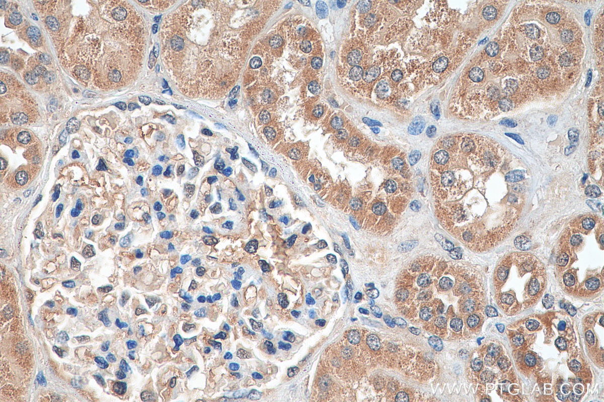 IHC staining of human kidney using 10069-1-AP