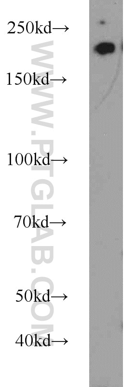 Western Blot (WB) analysis of HeLa cells using RB1CC1 Polyclonal antibody (10069-1-AP)